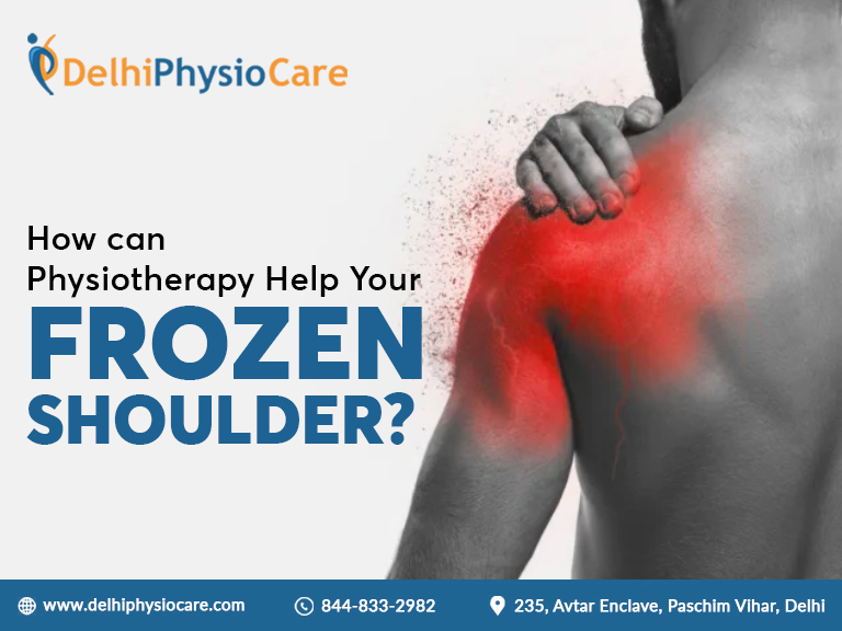 How can physiotherapy help your frozen shoulder?