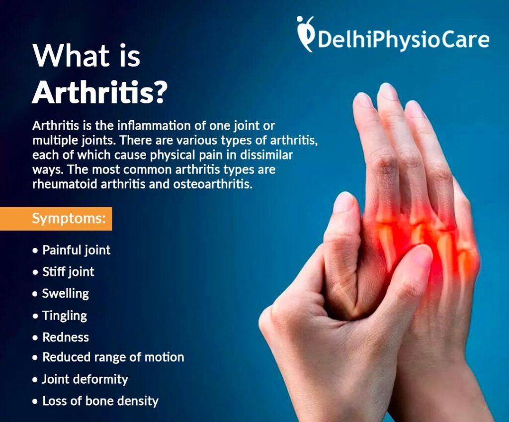 Rheumatoid Arthritis - Dr Shruti's Delhiphysiocare